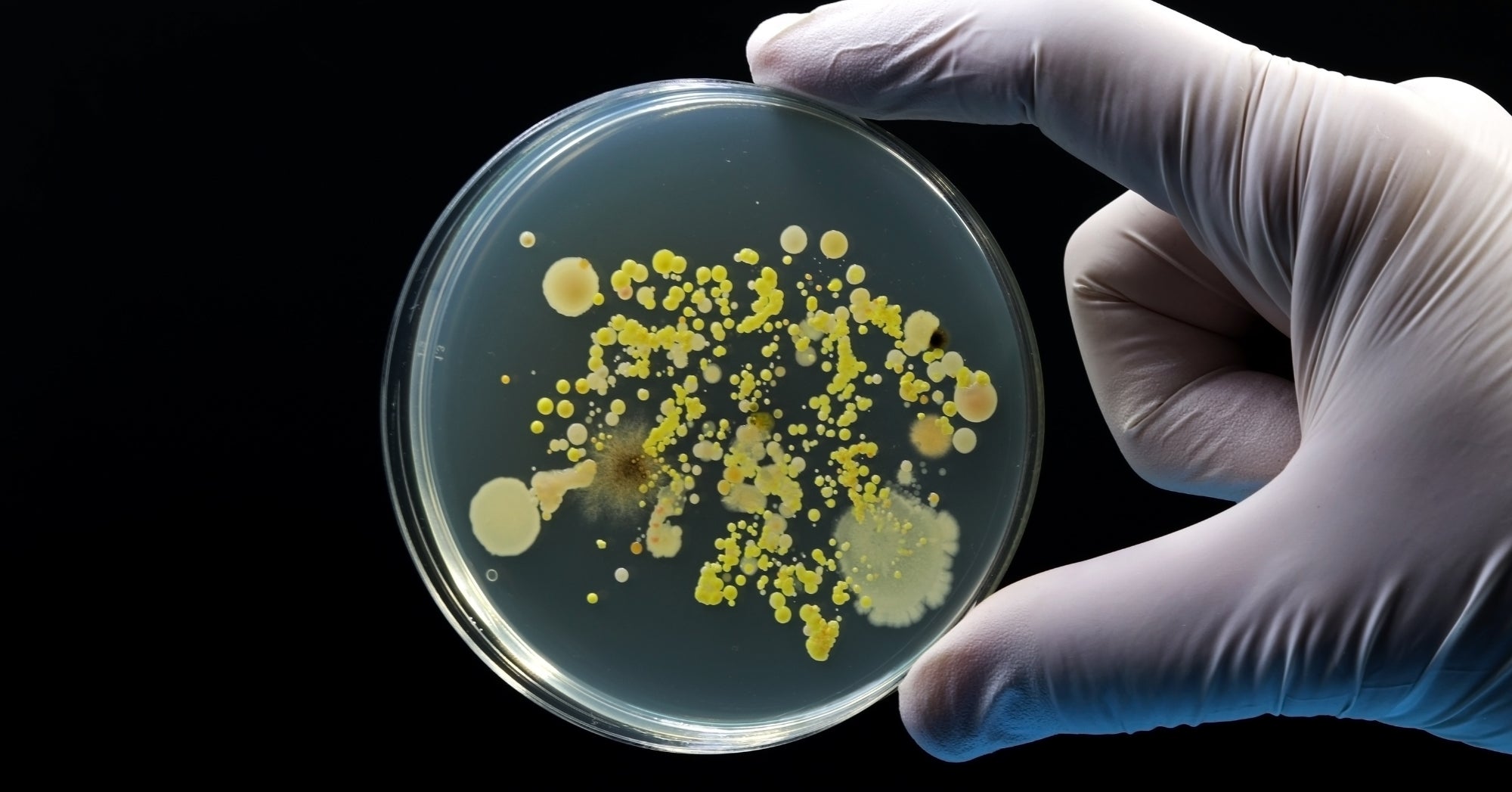 Salmonella